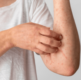 skin-allergy-reaction-person-s-arm_23-2149140472